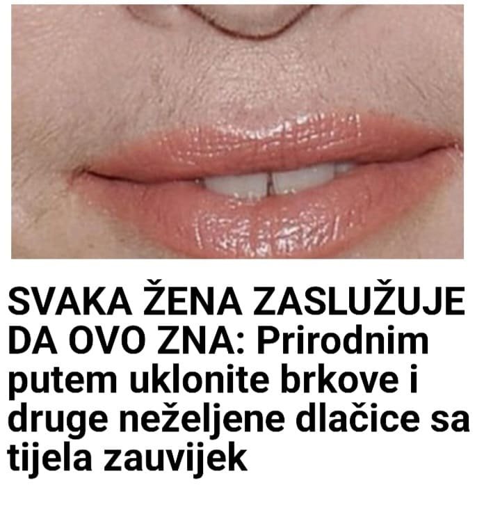 SVAKA ŽENA ZASLUŽUJE DA OVO ZNA: Prirodnim putem uklonite brkove i druge neželjene dlačice sa tijela zauvijek - featured image