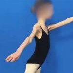 Devojčicu doveli u bolnicu, imala je samo 28 KG I RUČICE TANKE KAO GRISINE: Kad su lekari shvatili koliko ima godina, samo su se UHVATILI ZA GLAVU Devojčicu doveli u bolnicu, imala je samo 28 KG I RUČICE TANKE KAO GRISINE: Kad su lekari shvatili koliko ima godina, samo su se UHVATILI ZA GLAVU - featured image