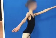Devojčicu doveli u bolnicu, imala je samo 28 KG I RUČICE TANKE KAO GRISINE: Kad su lekari shvatili koliko ima godina, samo su se UHVATILI ZA GLAVU Devojčicu doveli u bolnicu, imala je samo 28 KG I RUČICE TANKE KAO GRISINE: Kad su lekari shvatili koliko ima godina, samo su se UHVATILI ZA GLAVU - featured image