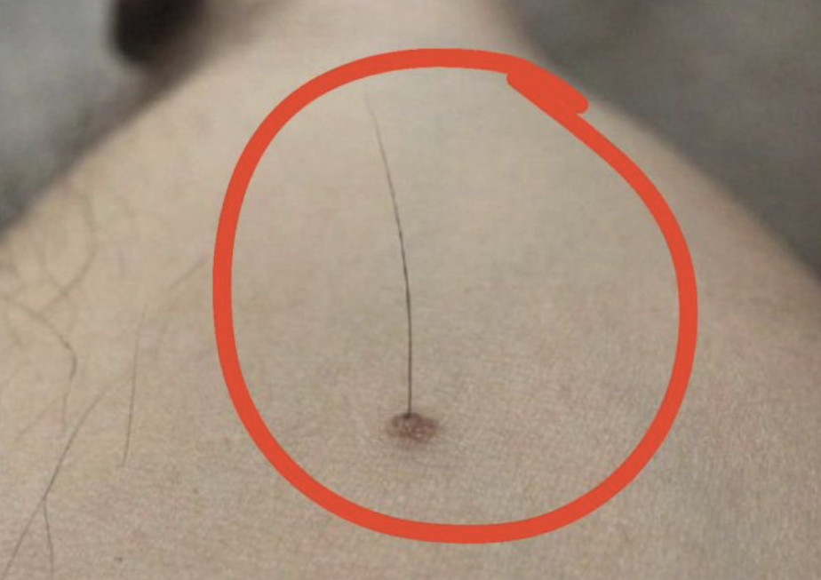 Evo šta tačno znači kada vam iz mladeža raste dlaka: Da li je to opasno, iznenadit ćete se - featured image Evo šta tačno znači kada vam iz mladeža raste dlaka: Da li je to opasno, iznenadit ćete se - featured image